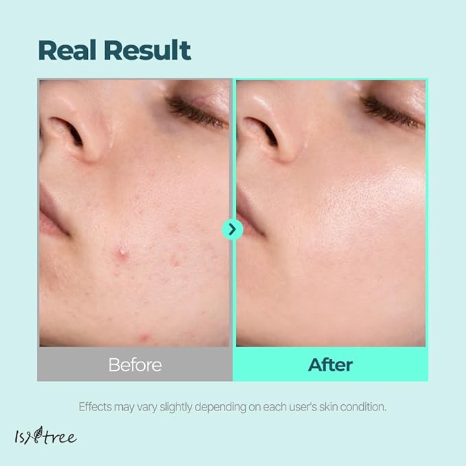 IsNtree Gim PDRN Deep Sleep Mask 80ml, 2.7 fl oz | Korean SEAWEED Skincare Sleeping Mask gel | Night Cream | Facial Mask | Overnight Gel mask for Hydration & Skin Bounce-BrightBean Baby