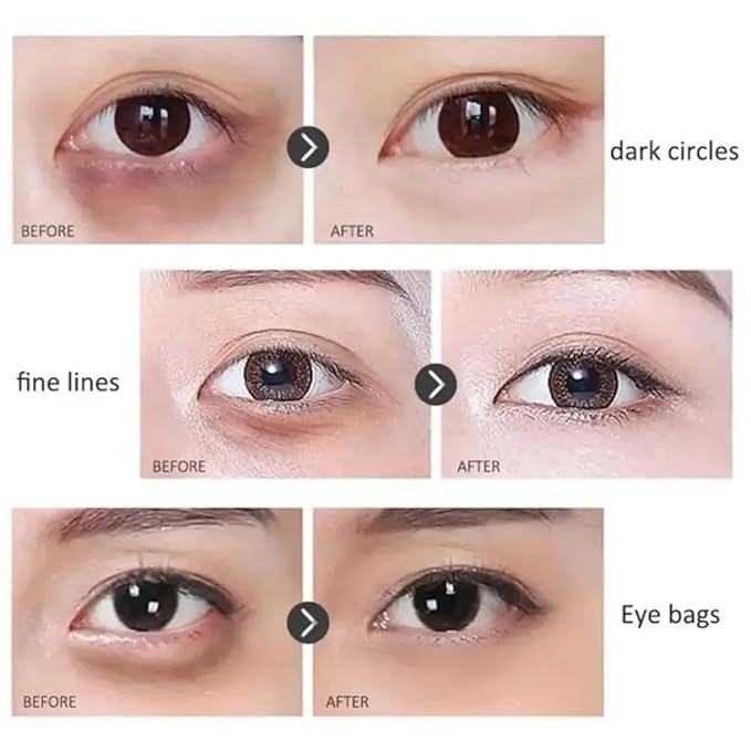 Time Eraser Rollerball, Retinol Anti-Wrinkle Eye Serum Oil, Eye Oil Roller, Reduces Fine Lines, Anti Wrinkle Serum For Eye-BrightBean Baby
