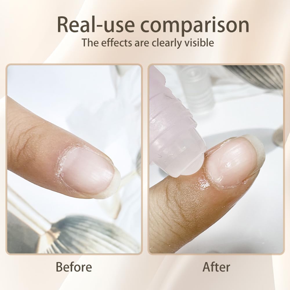 5pcs Cuticle Oil Roller Nourishing Moisturizing Roll On Cuticle Oil for Convenient Portable Nail Rollerball for On the Go Hydration and Care-BrightBean Baby