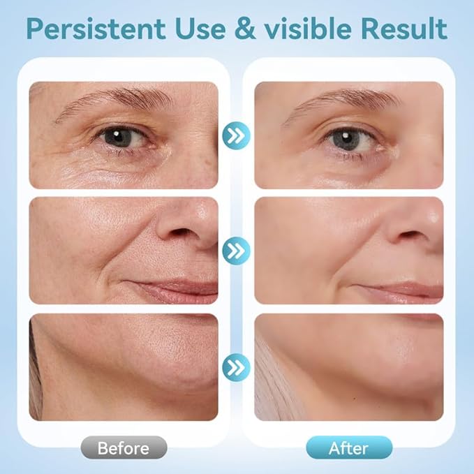 Neck Face Massager, 7-in-1 Portable Facial Massager for Enhanced Face, Neck and Shoulder Care with Vibrating and Warming Function，White-BrightBean Baby