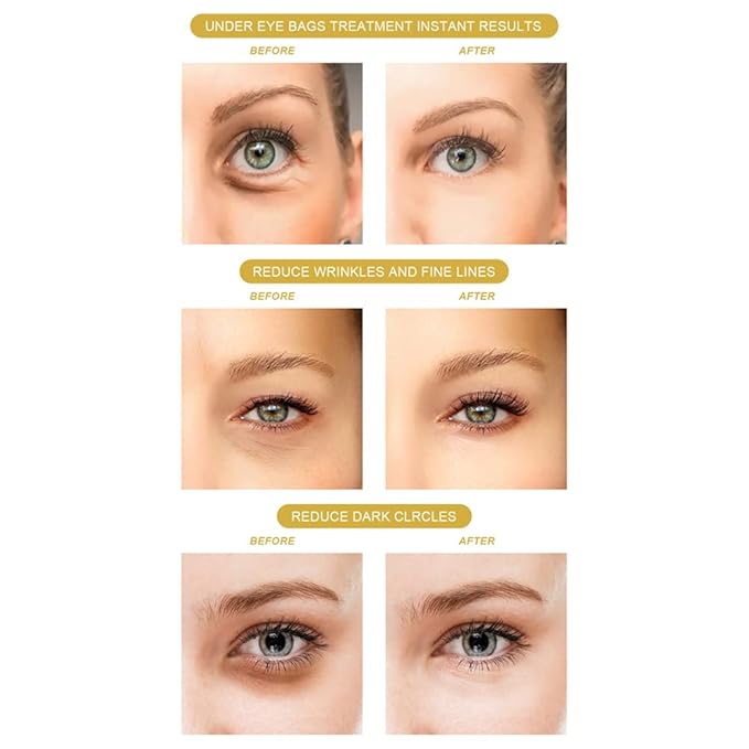 120PCS Under Eye Patches 24K Gold Eye Mask with Aloe Vera Natural Ingredients, Moisturizing Skin Care with Hyaluronic Acid and Collagen for Anti-Wrinkle, for Dark Circles and Puffiness-BrightBean Baby