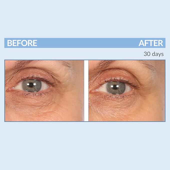 Serious Skincare - Eyetality Morning Total Eye Care Cream - For Lines, Wrinkles, Under Eye Puffiness and Dark Circles - Coffee Bean Extract - Vitamin C - Pomegranate - 0.5 oz-BrightBean Baby