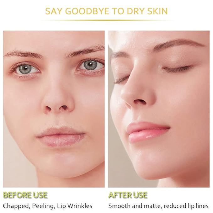 20Pcs Moisturizing Lip Mask, Restores Moisture Lip Care Mask for Dry Lips and Lip Lines Lips Overnight Lip Care, Gel Treatment Lip Masks Plumping Lips Mask (Yellow)-BrightBean Baby