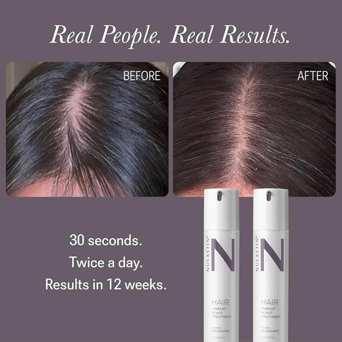 NULASTIN Hair Serum - HAIR Vibrant Scalp Treatment - Promote Scalp Care & Thicker Looking Volume in Thinning Hair - With Keratin & Peptides to Help Minimize Visible Shedding (2 Count, 1.7 Oz Each)-BrightBean Baby