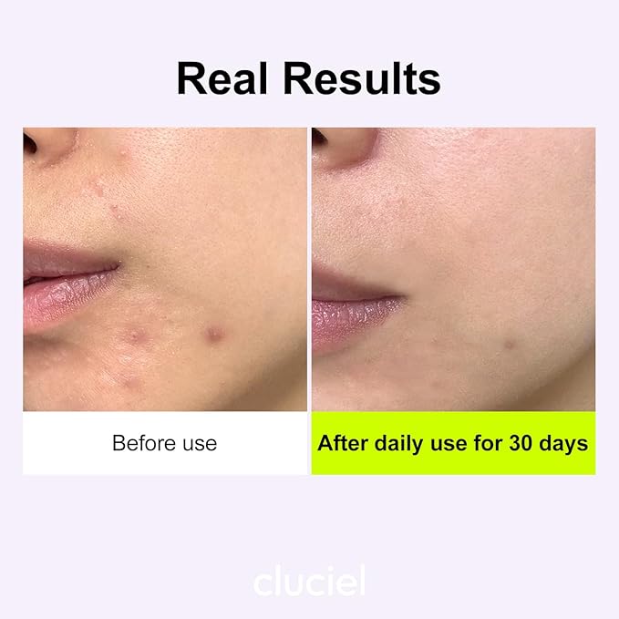 Niacinamide Peptide Serum I Repairing Serum, Targets Dullness, Dark Spots, Hyperpigmentation, Blemishes, Pore Care, Korean Glass skin (50ml / 1.69 fl.oz)-BrightBean Baby