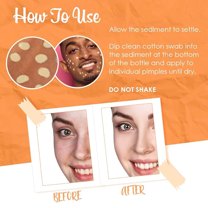 Bye Bye Blemish Dark Spot Lotion Vitamin C | Assists with Drying Blemishes And Brightening Skin | Fast Acting Solution | 1 Fl. Oz.-BrightBean Baby