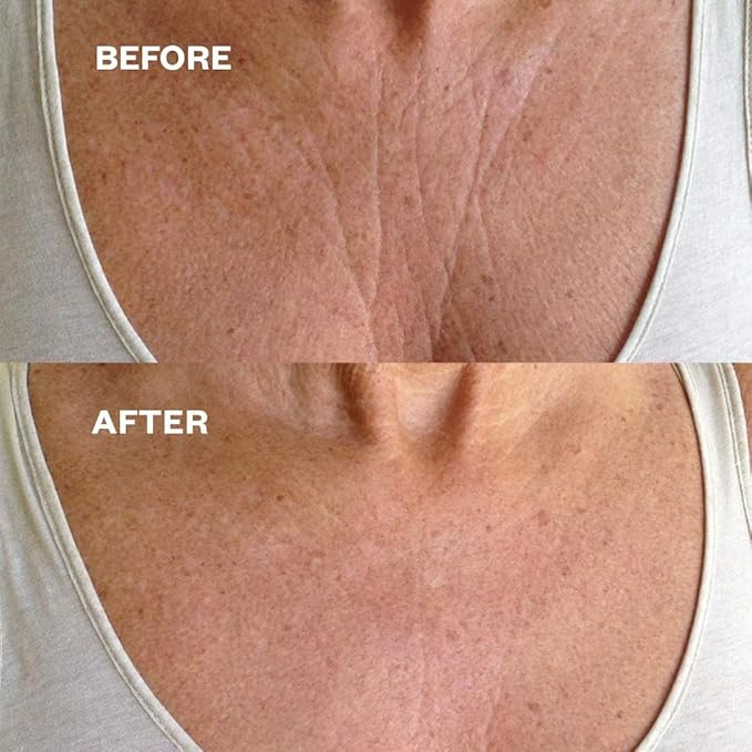 Wrinkles Schminkles Chest, Cleavage & Body Stretch Mark Wrinkle Patches | Reusable Hypoallergenic Pregnancy Safe Silicone Smoothing Pads to Prevent and Reduce Wrinkles & Stretch Marks | 2 Pack-BrightBean Baby