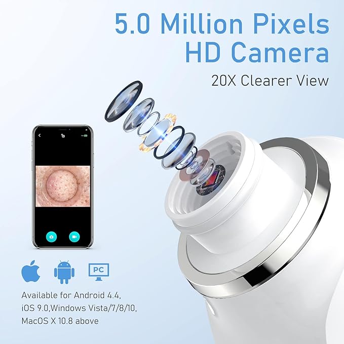 Facial Pore Blackhead Remover Vacuum, 1080P Camera Blackhead Remover, 20x Zoom, 8 LEDs ＆ 3 Suction Modes, 800mAh Battery & USB - 6 Heads Pore Cleaner Kit for Women&Men(Blue)-BrightBean Baby