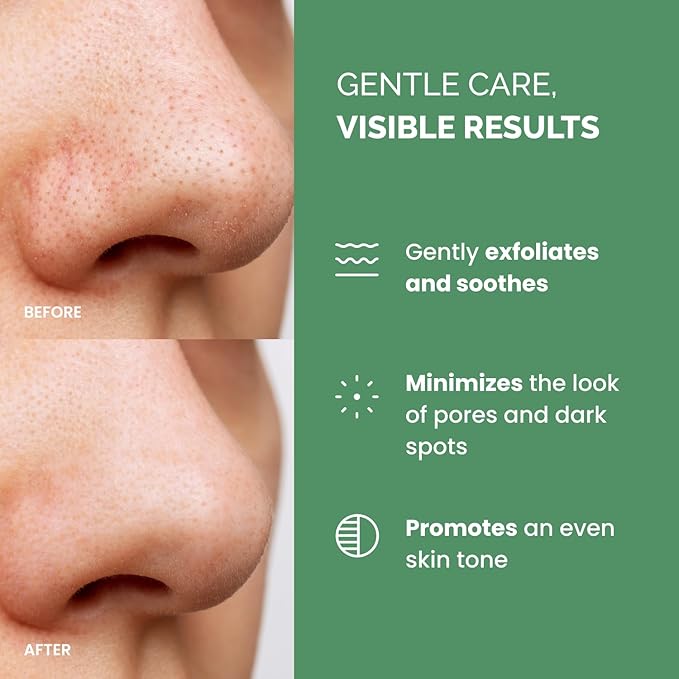 PLANTIFIQUE Korean Glycolic Acid Toner Pads 60 Pcs with Niacinamide, CICA - AHA BHA PHA Face Daily Peel Exfoliating Pads Formula for Gentle Skin Renewal for All Skin Types - Refillable Container-BrightBean Baby