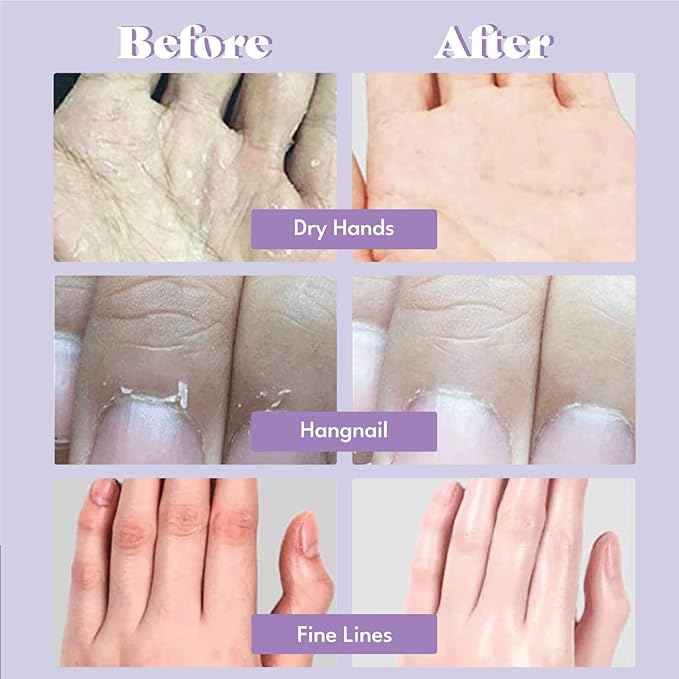 Toi:L Extra Silky Hand Mask 5 Pairs, Korean Moisturizing Gloves for Dry Hands with White Truffle, Green Caviar & Peptides, Repairing and Softening Hand Care Treatment for Aging, Cracked, and Dry Skin-BrightBean Baby