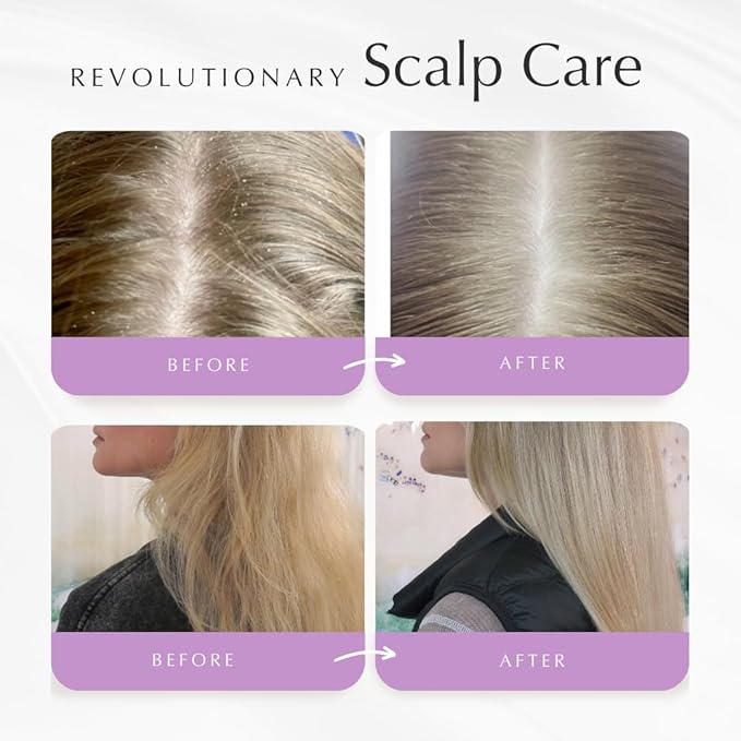 Citrus Cider Whip Hair Plaster | Vitamin C Infusion for Radiant Hair | Fruit Butters, Orange Peel Serum, Argan & Coconut Oils | Transform Damaged Hair Into Silky Mane-BrightBean Baby