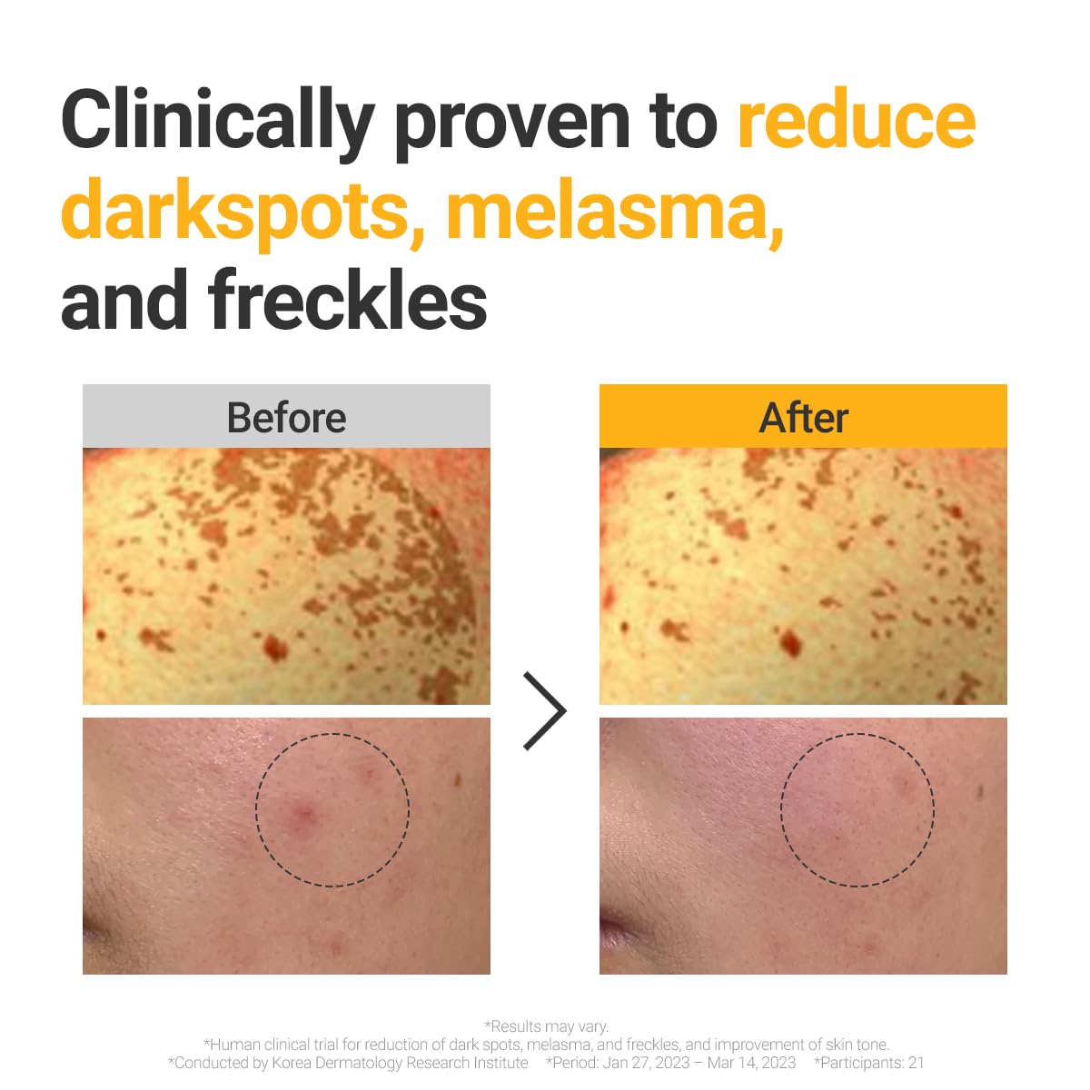 ROVECTIN Vita Dark Spot Serum for Clearing Blemish and Evening Skin Tone | Rich Vitamin C, Brightening, Hydrating For Dry, Sensitive, Normal, Oily Skin | Vegan K-Beauty (1.01 Fl. Oz, 30ml)-BrightBean Baby