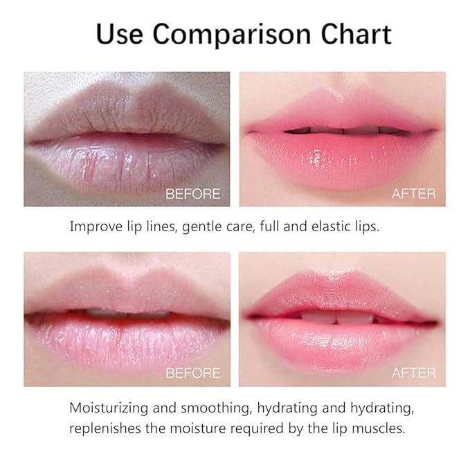 20Pcs Moisturizing/Plumping Lip Mask, Restores Moisture Mask for Dry Lips and Lines Overnight Care, Gel Treatment Masks (Pink)-BrightBean Baby