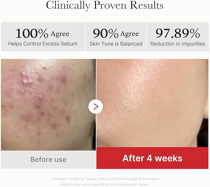 Medicube Red Succinic Acid Panthenol Facial Peeling Pads - Exfoliating Toner Pads for Breakout-Prone Skin with Niacinamide, AHA, BHA, and Soothing Panthenol - Non-Comedogenic-BrightBean Baby