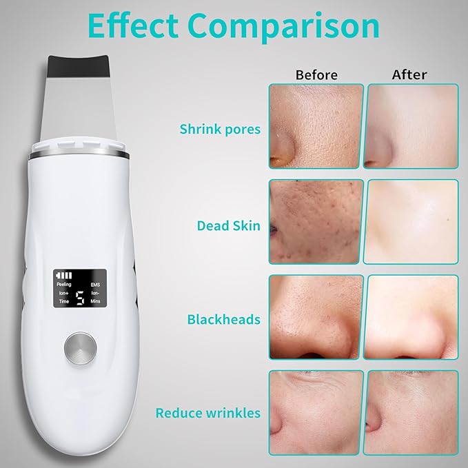 Skin Scrubber Face Spatula - 4-in-1 Deep Cleansing Tool for Pore Extraction, Fast Charging Dock Blackhead Remover Face Spatula for Facial Skincare Women Gift (White)-BrightBean Baby