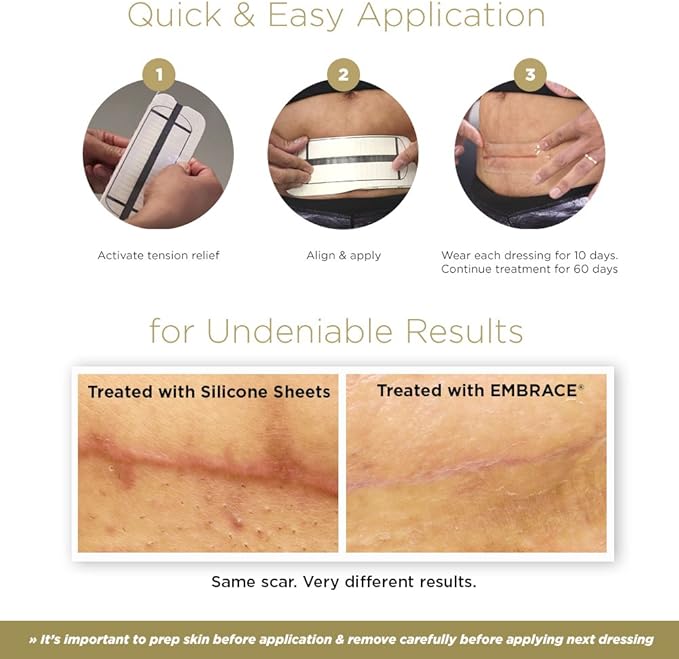 Embrace Active Scar Defense for New Tummy Tuck Scars, FDA-Cleared Extra-Large Silicone Scar Sheets, 30 Day Supply-BrightBean Baby
