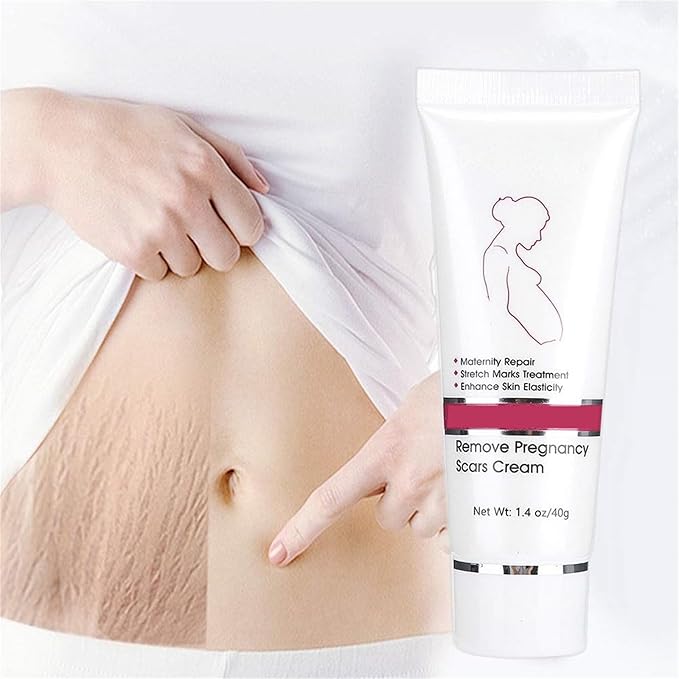 RtopR Stretch Marks and Scar Cream,Crema para Estrias De Embarazo,Stretch Marks Postpartum Repairing Cream Wrinkles Diluting Removal Cream Crema De Cacao para Cicatrices-BrightBean Baby