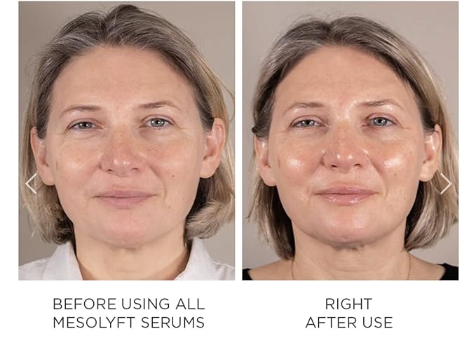 Power Combo Neck & eye Roller Brightening Face Serums for Anti-Aging Get Lip Pump's best Lip Plumper an Effectively Aging Skin Serum Multi-purpose, Eyes Neck & Décolleté Beauty Serum-BrightBean Baby