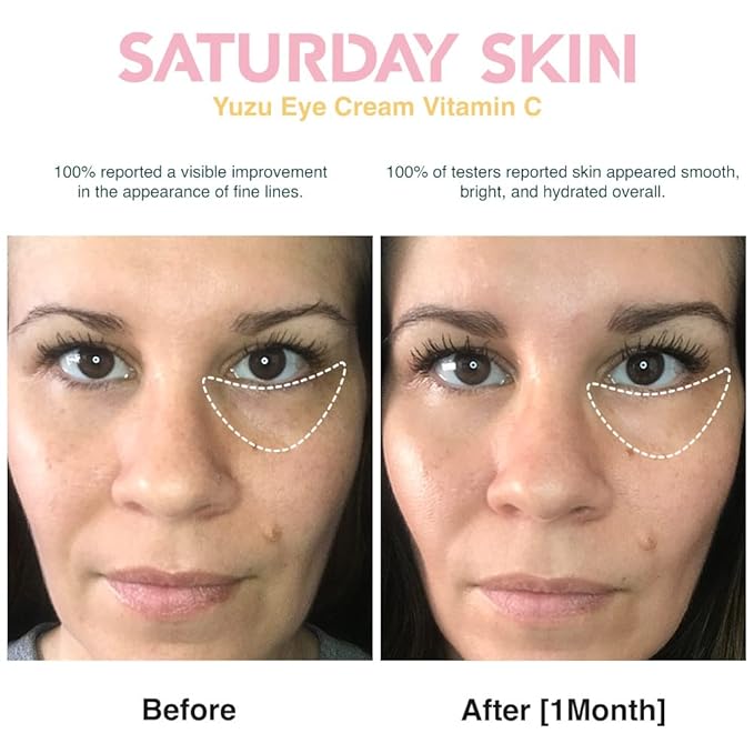 Saturday Skin Yuzu Eye Balm Vitamin C Wide lluminating Under Tight Eye Cream Korean Niacinamide Caffeine for Wrinkles Puffy Eyes Dark Circles Moisturizing Hydrates Anti Aging for Women (15ml)-BrightBean Baby