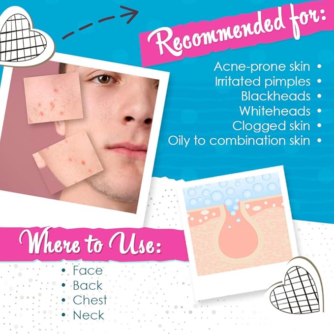 Bye Bye Blemish Acne Drying Lotion, On-the-Spot Pimple Treatment, Reduce Pimples Overnight, Beauty Skincare Essential - 1oz. (2-Pack)-BrightBean Baby