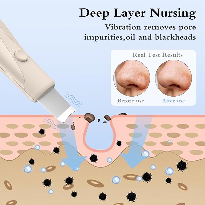 Skin Scrubber Face Spatula Skin Spatula Pore Cleaner Blackhead Remover Tools for Facial Deep Cleansing Skin Care Tool for Men and Women (Beige)-BrightBean Baby