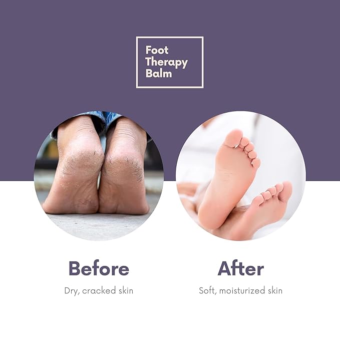 Victoria's Lavender Ultra Rich Foot Balm for Dry Cracked Feet – Heel Repair & Softener with Tea Tree Oil & Lavender – Dry Heels Treatment for Women & Men – Made in USA Foot Balm Stick - 2 Pack (2.5Oz)-BrightBean Baby