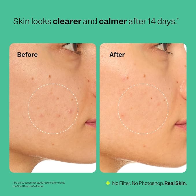 Peach Slices | Snail Rescue Intensive Treatment Wash-Off Face Mask | 95% Snail Mucin | For Dark Spots & Blemishes | Refreshing & Calming Mask | Clear, Radiant, & Hydrated Skin | Skin Care | 3.38 oz-BrightBean Baby