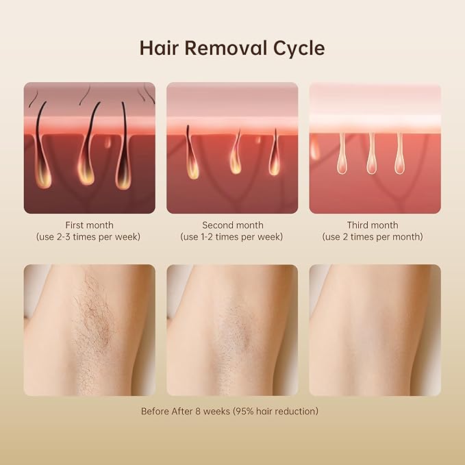 Laser Hair Removal IPL Laser Hair Removal for Women and Men Permanent, 999999 Flashes, At-Home Hair Removal Device for Facial Legs Arms Whole Body Use (White Gold)-BrightBean Baby