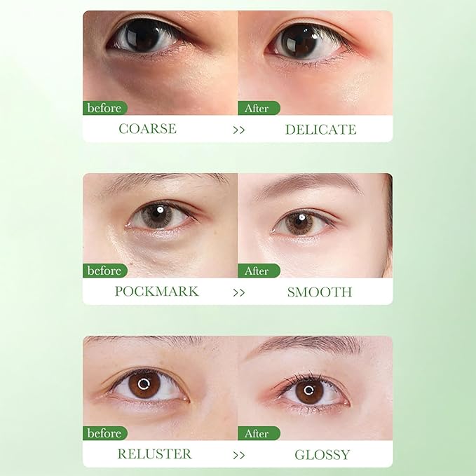 BIOAQUA Centella Asiatica Nourish Repair Eye Cream Soothing Oil Control Anti-Acne 20g / 0.7oz-BrightBean Baby