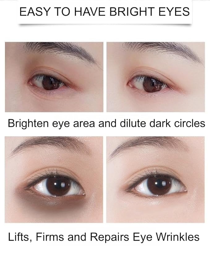 Under Eye Patches - 24K Gold Eye Mask,Moisturizing Serum for Firming, Brightening, and Relieving Eye Fatigue - Under Eye Patches for Dark Circles and Puffiness (gold)-BrightBean Baby