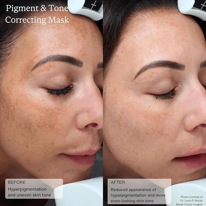 Senté Cysteamine HSA Pigment and Tone Corrector- Hyperpigmentation Treatment For Reducing The Appearance of Dark Spots And Improving Skin Tone - 1.7 Fl Oz-BrightBean Baby