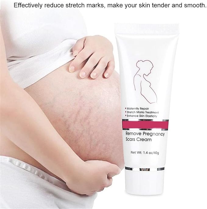 RtopR Stretch Marks and Scar Cream,Crema para Estrias De Embarazo,Stretch Marks Postpartum Repairing Cream Wrinkles Diluting Removal Cream Crema De Cacao para Cicatrices-BrightBean Baby