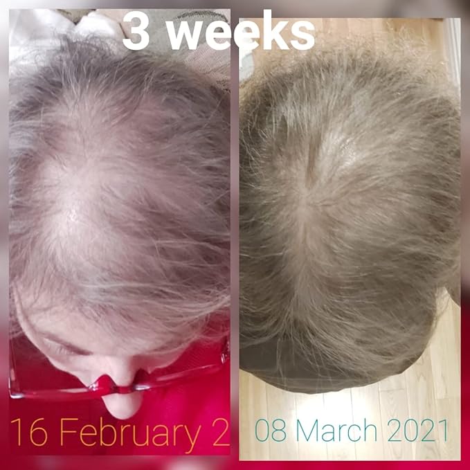 CRISAN 16oz Extreme Hair Growth and Strengthening Oil for Men and Women (16 fl oz)-BrightBean Baby