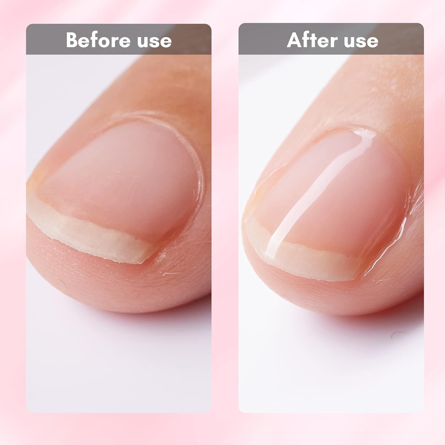 Makartt Gel Nail Strengthener Reinforce Polish, Nail Strengthening Repair Polish Nail Hardener for Treating Weak Damaged Peeling Nails Clear Soak Off Gel Lacquer Long Lasting Professional DIY Nail Art-BrightBean Baby