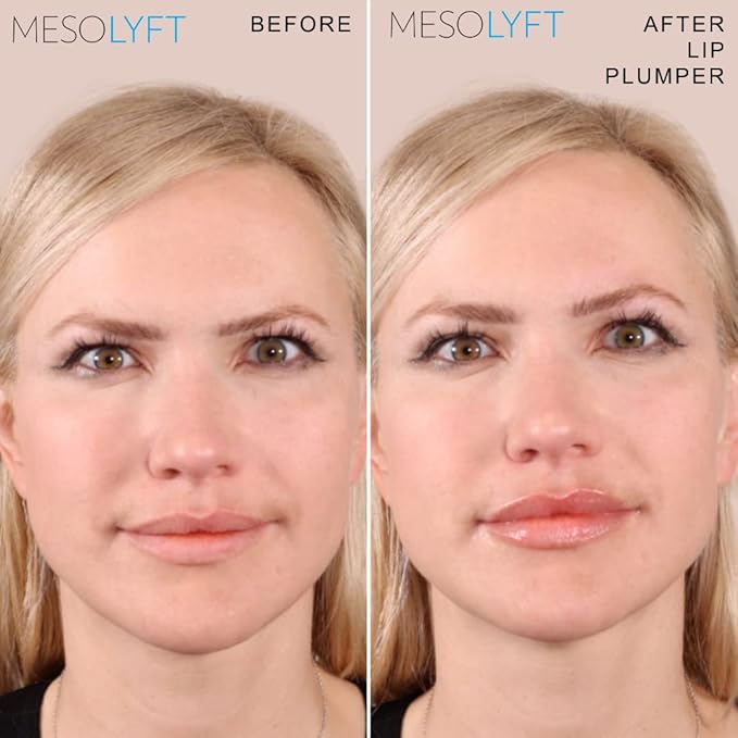 Power Combo Neck & eye Roller Brightening Face Serums for Anti-Aging Get Lip Pump's best Lip Plumper an Effectively Aging Skin Serum Multi-purpose, Eyes Neck & Décolleté Beauty Serum-BrightBean Baby