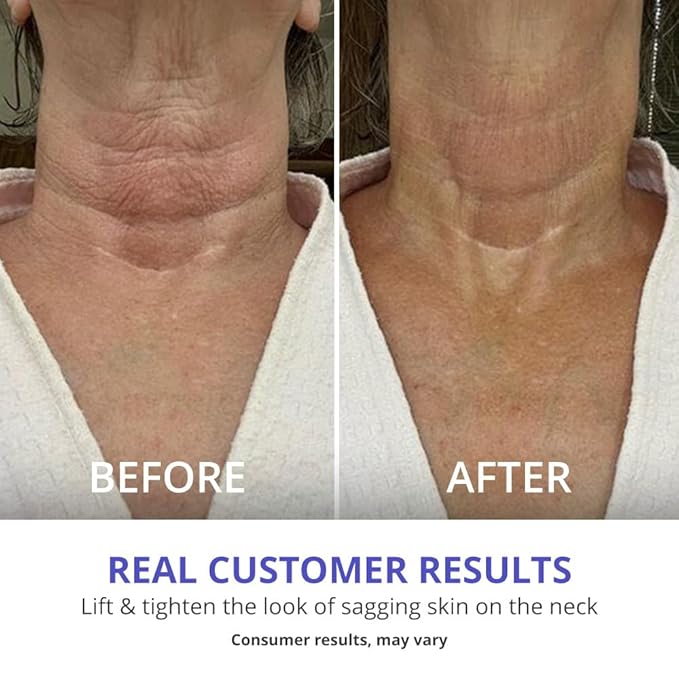 goPure Tighten and Lift Neck Cream - Clinically Tested - Pack of 2-BrightBean Baby