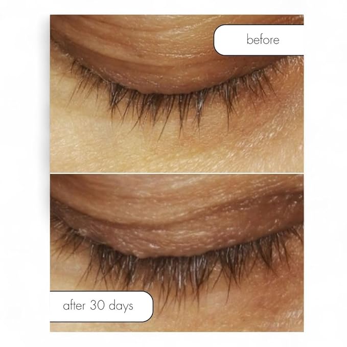 Serious Skincare Lash Bath & Conditioner - Double Action Eye Makeup Remover - Oil Free - Enhancing Peptides Promotes Eyelash Growth - Clover Flower - Effortlessly Removes Waterproof Mascara - 4 oz.-BrightBean Baby