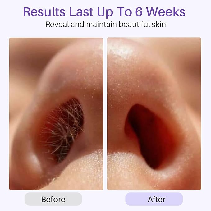 BLITZWAX Single Waxing Pot, Hard Wax Warmer for Face, Legs, Bikini, Brazilian and Body, for 16 oz, At Home Hair Removal Kit, for Men, Beginner Friendly, Quick Heating, Precise Temperature Control-BrightBean Baby