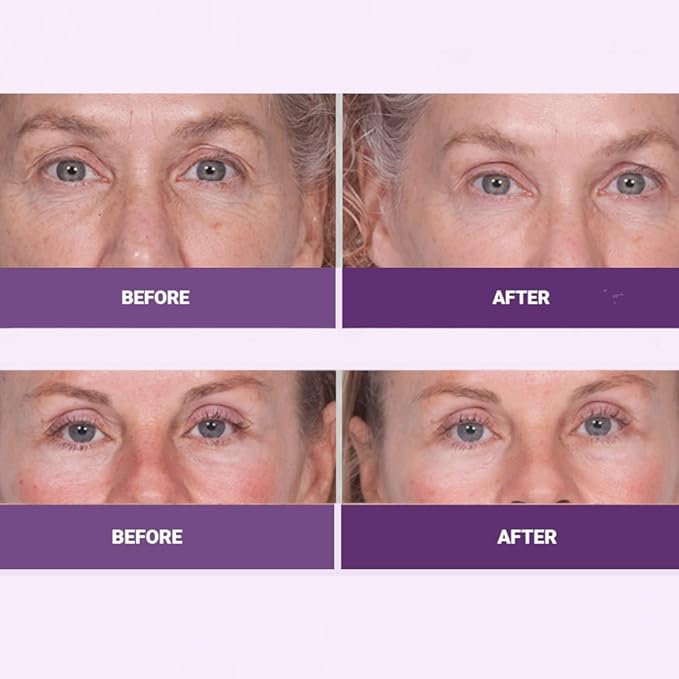 Serious Skincare INSTA-TOX Facial Firming Wrinkle Smoothing Serum and Reverse Lift Firming Eye Cream Set - Filler for Fine Lines, Deep Wrinkles and Pores - Temporary Eye Tightener-BrightBean Baby