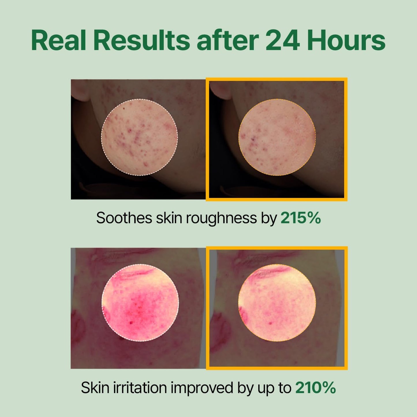 Mugwort Super Calming Toner - Korean Hydrating Toner for face, Purifying Mugwort Essence, Soothing, Calming, Refreshing Facial Toner for Oily, Dry, and Sensitive Skin, Daily Skin Care, 8.45 fl.oz-BrightBean Baby