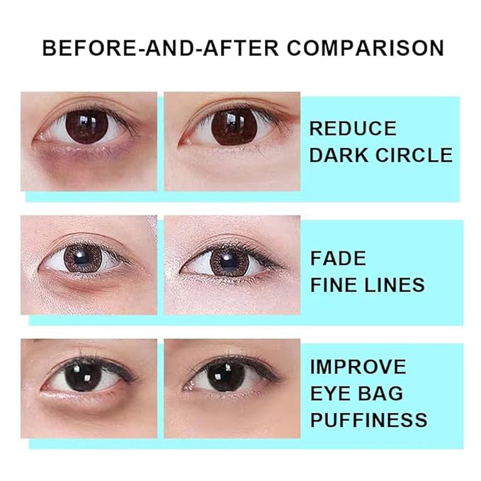 Snail Peptide Eye Cream, Snail Mucin Eye Cream Contains Niacinamide, Hyaluronic Acid To Reduce Wrinkles, Dark Circles, Puffiness and Fine Lines 17 ML-BrightBean Baby