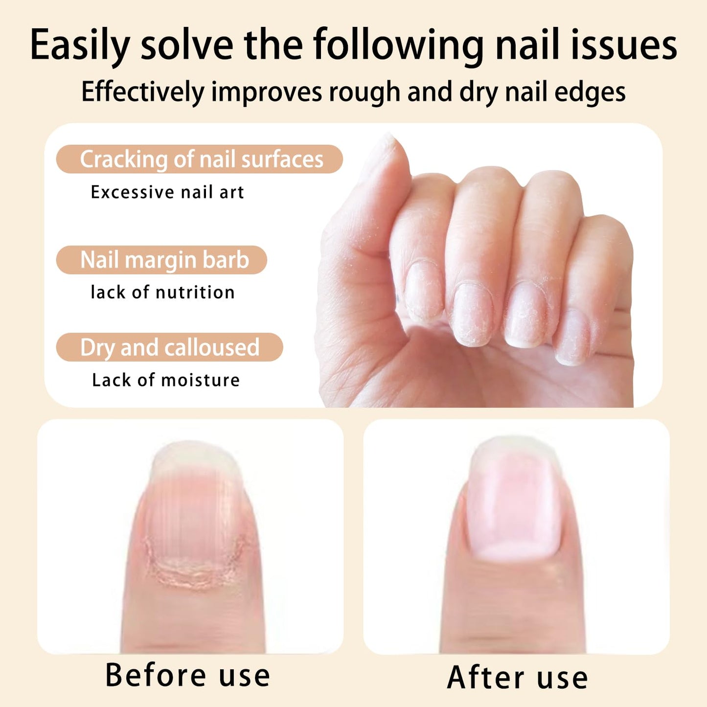 28PCS Cuticle Oil Pen Sweet Almond Nail Growth Serum and Repair Treatment Hydrating Oil for Dry Cuticles and Skin Cuticle Buddy Revitalize Nails with Radiant Cosmetics' Nail Growth Oil-BrightBean Baby