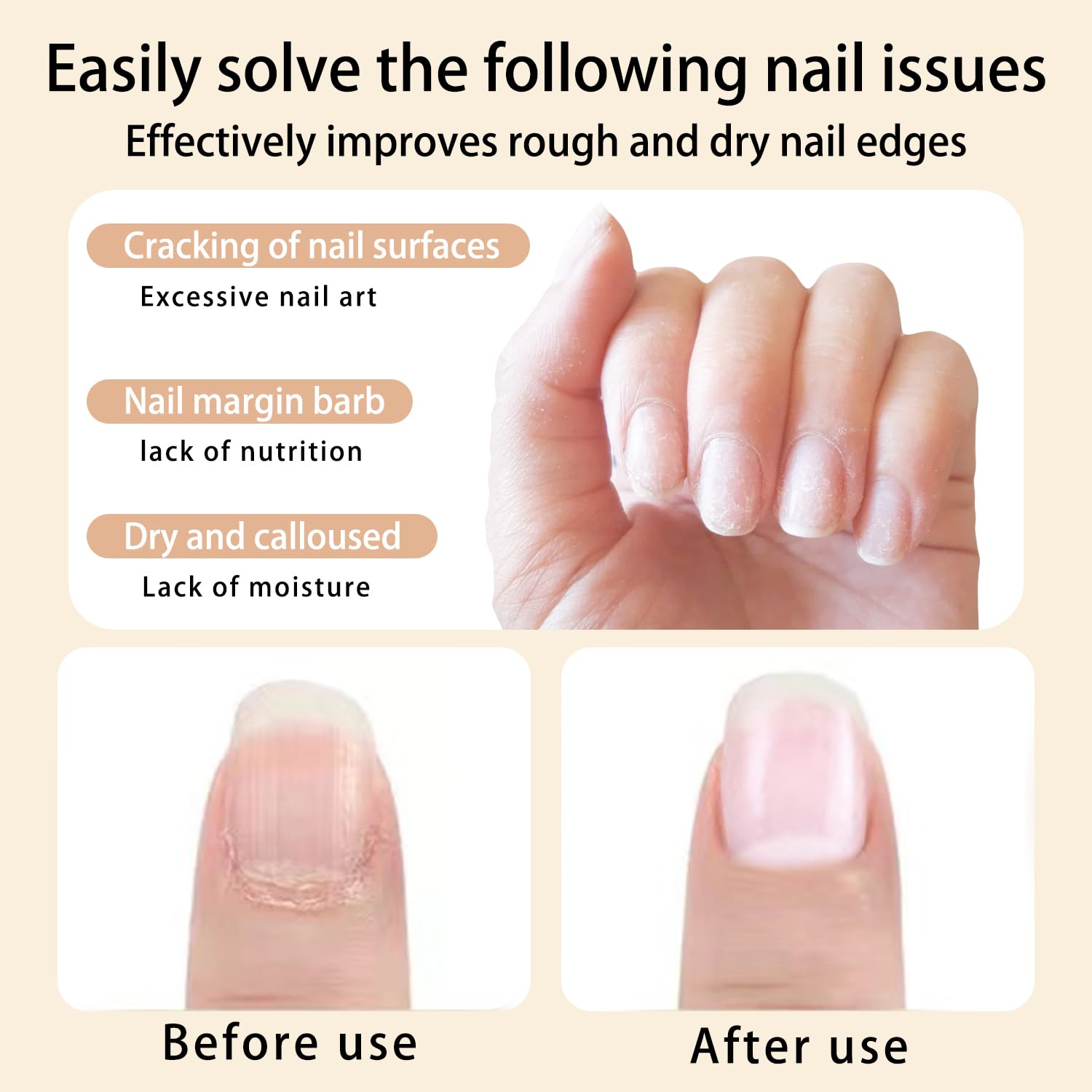 28PCS Cuticle Oil Pen Sweet Almond Nail Growth Serum and Repair Treatment Hydrating Oil for Dry Cuticles and Skin Cuticle Buddy Revitalize Nails with Radiant Cosmetics' Nail Growth Oil-BrightBean Baby