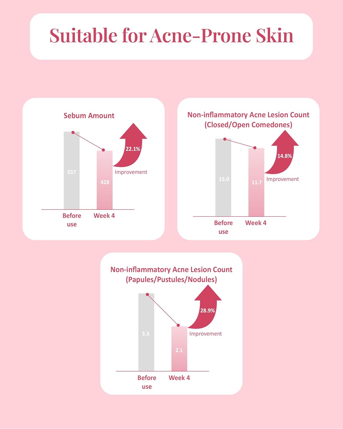 Pink Blemish Calming Serum (1.7fl oz) - Hydrating, Soothing Korean Skin Care for Sensitive Skin. Vegan Hyaluronic Acid, Niacinamide.-BrightBean Baby