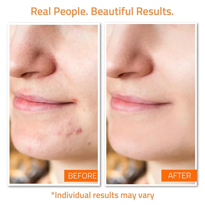 YEOUTH Skin Care Set: Vitamin C Face Wash, Toner, Vitamin C & Retinol Serum, Face Cream, Peel & Mask 7- Piece Skincare Gift Set for Teens, Women & Men-BrightBean Baby