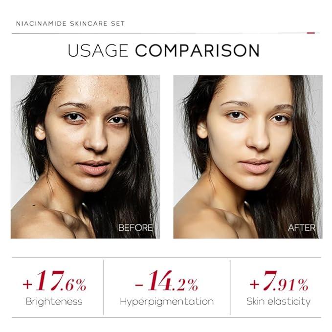 Niacinamide Skincare Set: 4pcs Beauty Kit with Cleanser, Toner, Serum, & Facial Cream - Hydrates & Evens Skin Tone - TSA-Friendly Travel Sizes, Perfect Gift for Women, Moms, & Teens-BrightBean Baby