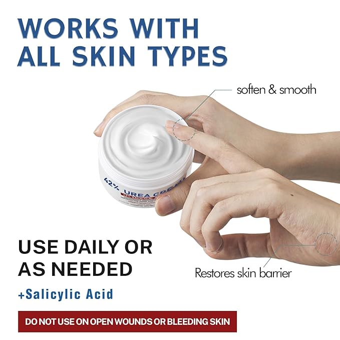 OUKEYA Urea Cream 42% plus Salicylic Acid 2% Net 5.29 Oz for Dry Cracked Feet,Heels,Knees,Elbows,Hands Repair Treatment Moisturizes and Removes Corns,Calluses,Dead Skin,and Softens Toenails-BrightBean Baby