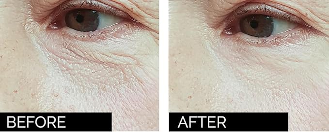 Anti-age under eye masks - With Hyaluronic Acid, Collagen & Vitamin C. Natural gel eye masks, under eye gel patches for dark circles & puffy eyes. Anti wrinkle skincare, hydrating & soothing. 20 pairs-BrightBean Baby