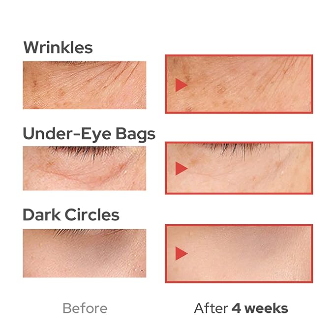 DUFT & DOFT Vgene Hydro Firming Lifting Booster Eye Cream - Anti Wrinkle, Dark Circles, Depuffing with Collagen and Niacinamide 0.9 Fl Oz-BrightBean Baby