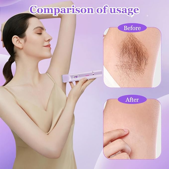 Women's Electric Dual Headed Shaver, 2 in 1 Bikini Trimmer, USB Rechargeable Electric Razors Body Hair Trimmer-BrightBean Baby